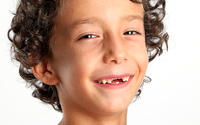 A young boy's mouth with missing teeth