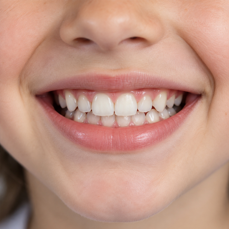 Close-up of a child's teeth representing which teeth may benefit from dental sealants